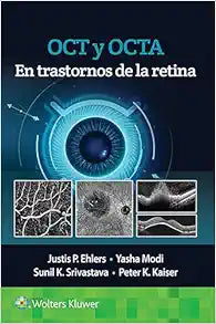 OCT y OCTA en trastornos de la retina